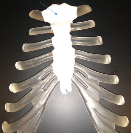 <p>What is this called?</p>