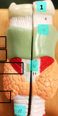 <p>Label this image.</p>