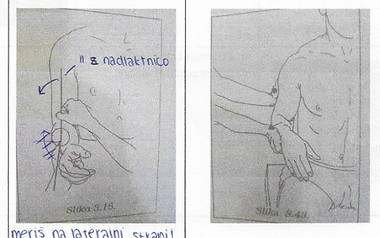 <p>Pronacija podlakti</p>