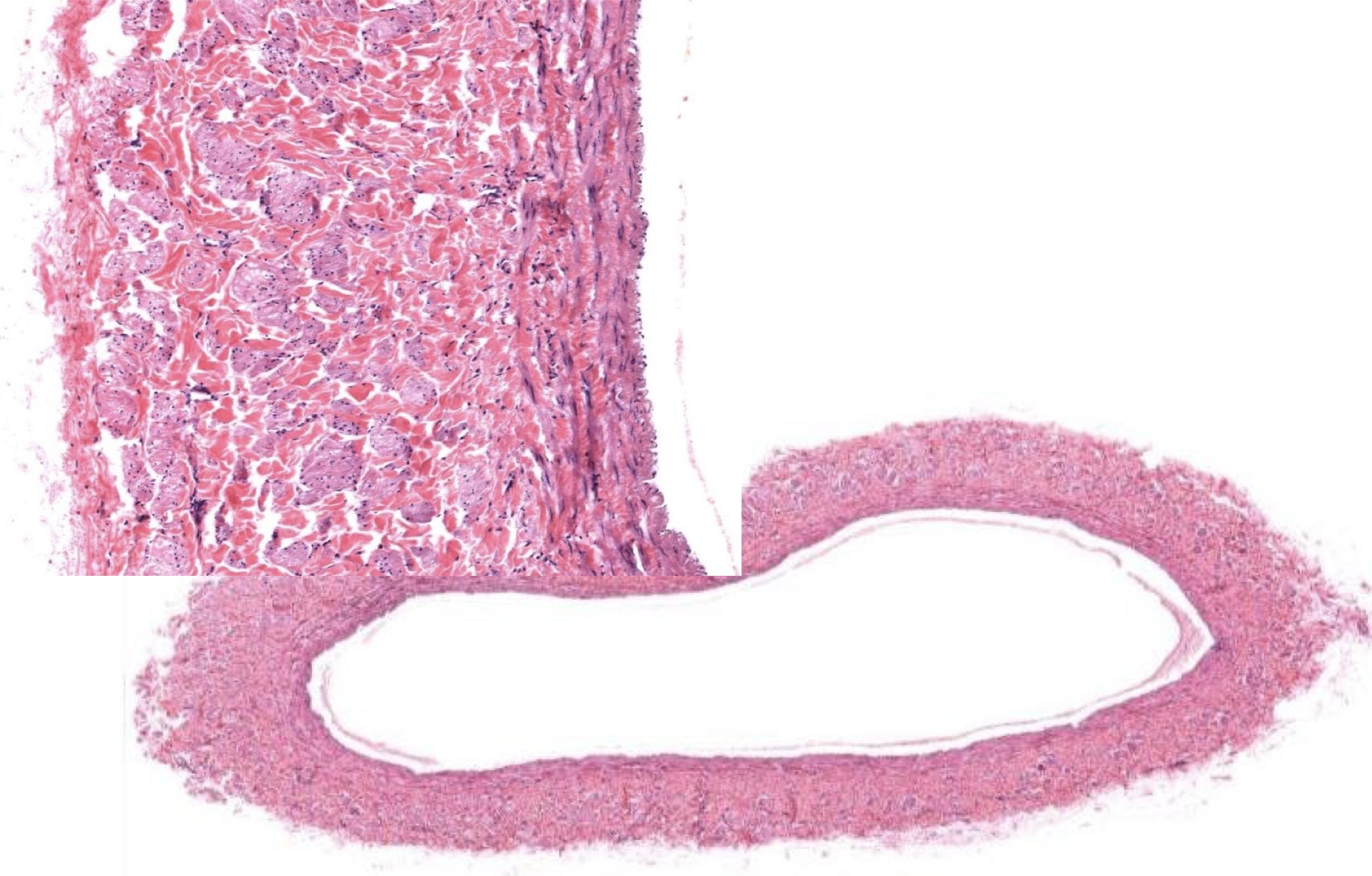 <p>Identify the Vessel and the Layer pictured</p>