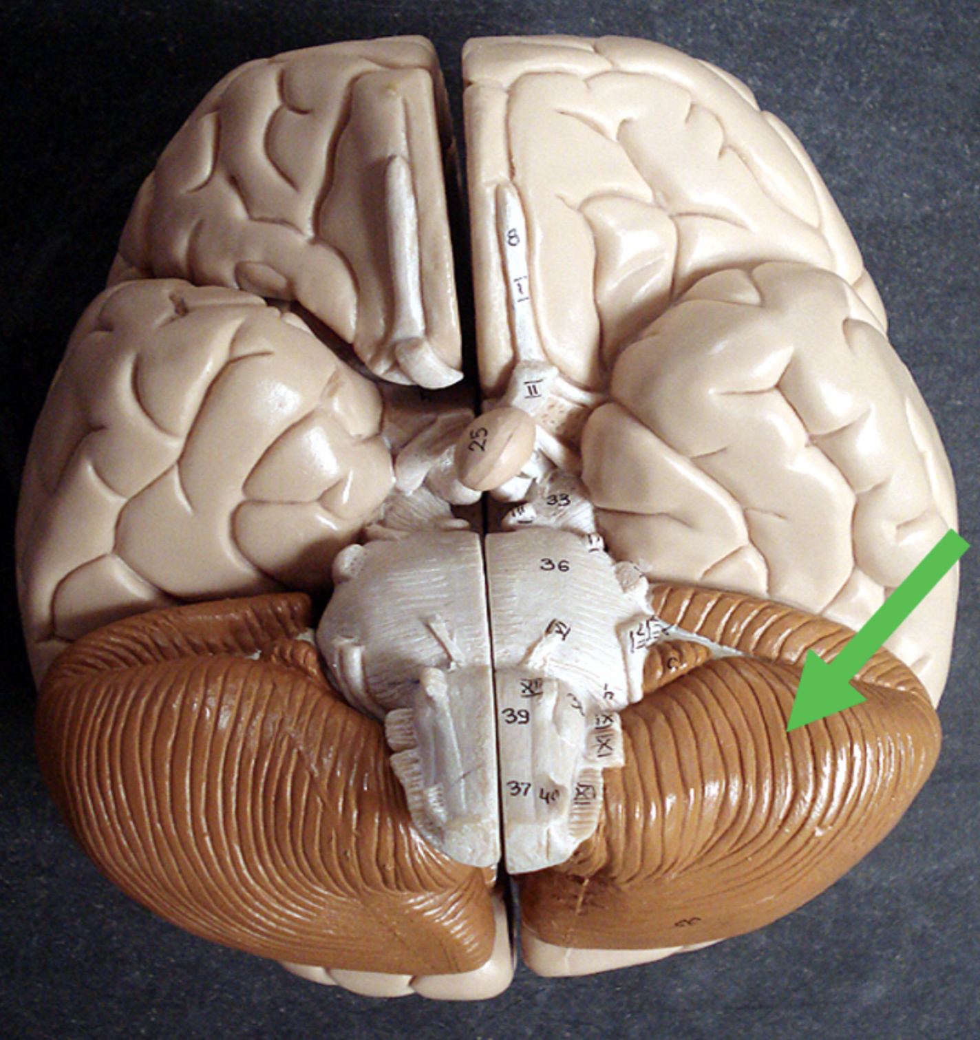 <p>Identify the area of the brain at the tip of the pointer.</p>