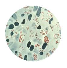 <p>does not gram stain well (stains pink with carbol fuchsin stain) </p>