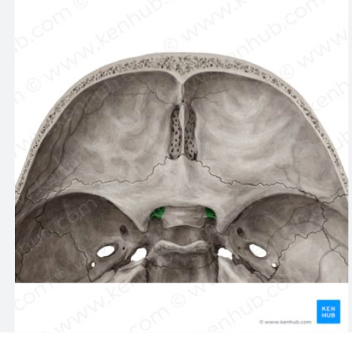 <p>What structure is highlighted in green? What would a lesion to this area cause?</p>