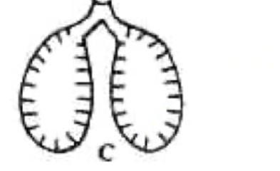 <p>What kind of creature has lungs that look like this?</p>