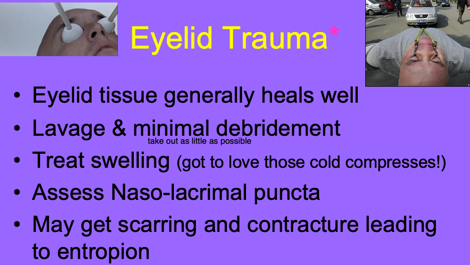 <p>scarring and contracture leading to entropion.</p>