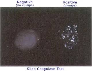 <p><mark>identifies whether a bacterium produces the </mark><strong><mark>coagulase enzyme</mark></strong><mark>, which clots blood plasma</mark>. It is primarily used to differentiate highly pathogenic <em>Staphylococcus aureus</em> (which is coagulase-positive) from less virulent, coagulase-negative staphylococci (CONS), like <em>S. epidermidis</em>. [1, 2, 3, 4]</p>