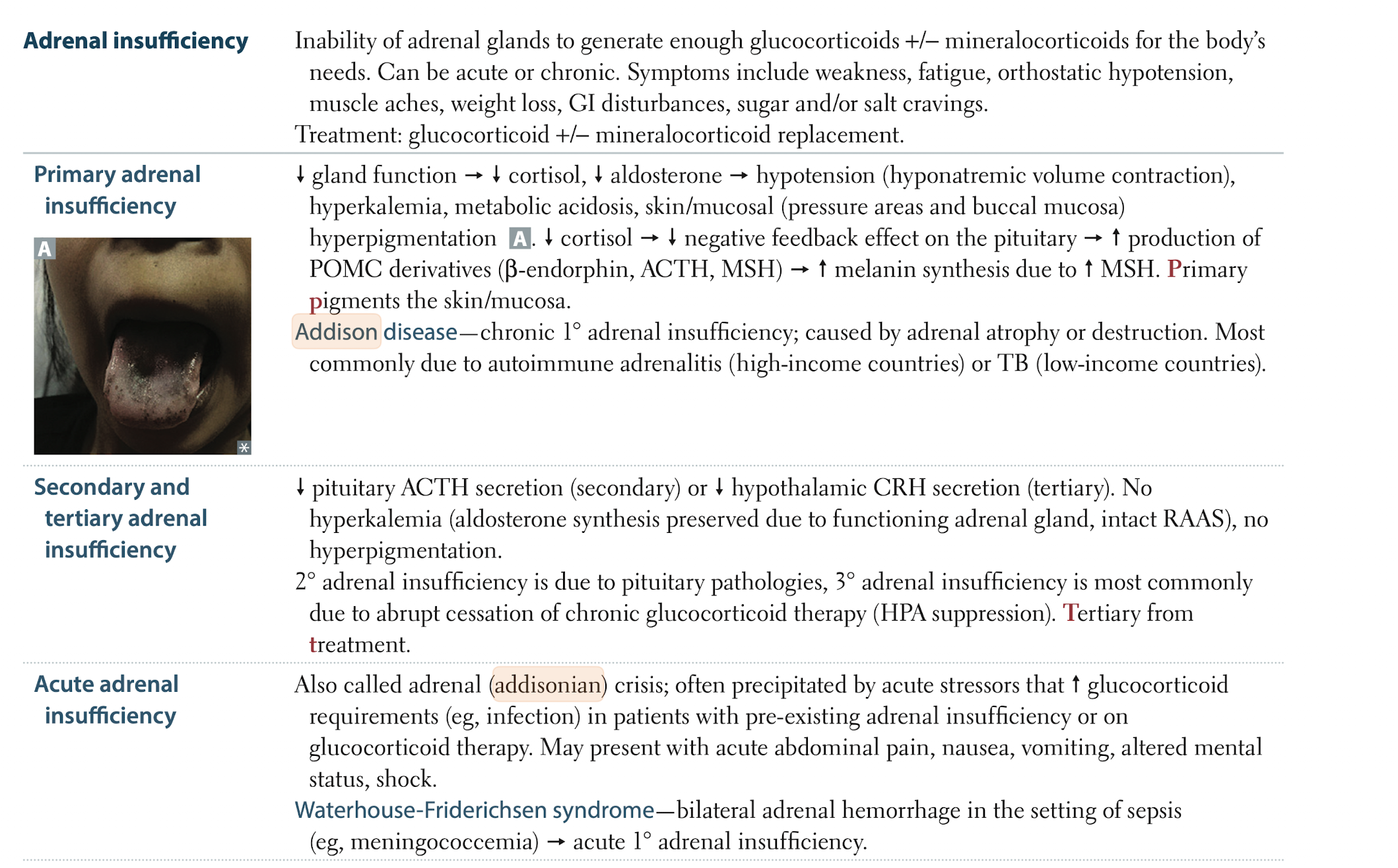 <p><span style="background-color: oklch(0.9798 0.005 78.3); color: oklch(0.2642 0.013 93.9);">Addison disease (primary adrenal insufficiency) presents with chronic fatigue, weakness, weight loss, GI symptoms, orthostatic hypotension, and often hyperpigmentation plus salt craving with hyponatremia and hyperkalemia; diagnosis is suggested by this clinical picture with low morning cortisol and high ACTH, confirmed by an ACTH (cosyntropin) stimulation test (poor cortisol rise) and supported by low aldosterone/high renin and adrenal autoantibodies when autoimmune; chronic treatment is lifelong glucocorticoid replacement (e.g., divided‑dose hydrocortisone) plus mineralocorticoid replacement with fludrocortisone, along with education on stress‑dose steroids, emergency injectable hydrocortisone, and rapid IV hydrocortisone with fluids for adrenal crisis.</span></p>