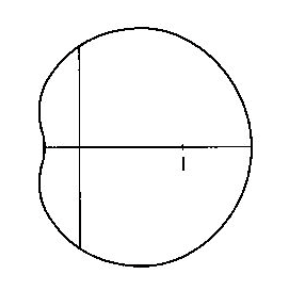 <p>dimpled cardioid</p>