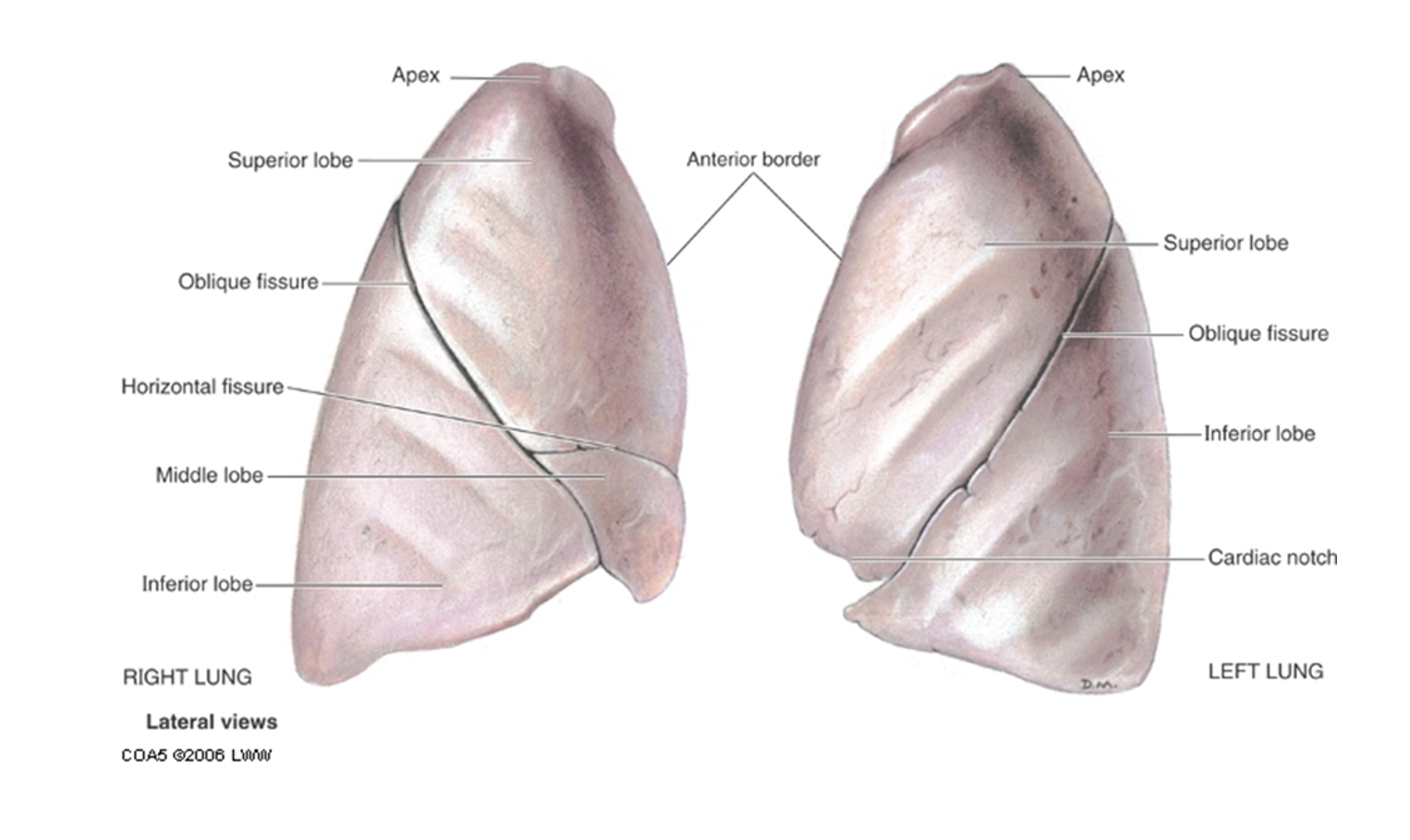 <p><span><strong>Right Lung</strong></span></p><p><span>●Three lobed</span></p><p><span>-Superior</span></p><p><span>-Middle</span></p><p><span>-Inferior</span></p><p></p><p><span>●Fissures</span></p><p><span>-Horizontal fissure</span></p><p><span>-Oblique fissure</span></p><p></p><p><span>●Primary bronchi more vertical than left</span></p><p><span>●Wider than left</span></p><p><span>●Pulmonary artery is anterior to bronchus at hilum</span></p><p></p><p><span><strong>Left lung</strong></span></p><p><span>•Two lobed</span></p><p><span>–Superior</span></p><p><span>–Inferior</span></p><p></p><p><span>•Oblique fissure</span></p><p><span>•Prominent impression from aorta and heart</span></p><p><span>•Lingula on inferior aspect of Superior lobe</span></p><p><span>•Pulmonary artery is superior to bronchus at hilum</span></p><p></p><p><span><em>RALS:  Pulmonary artery to Bronchus → Right anterior, left superior</em></span></p>