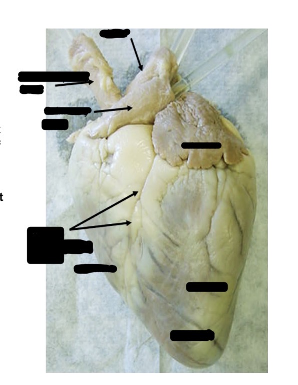 <p>Label the heart</p>