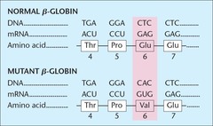<p>A mutant form of hemoglobin due to a mutation in the gene encoding β-globin</p>