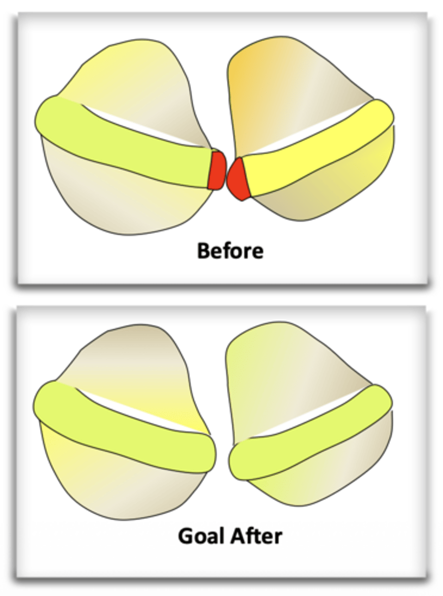 <p>ID feature of aligner:</p>