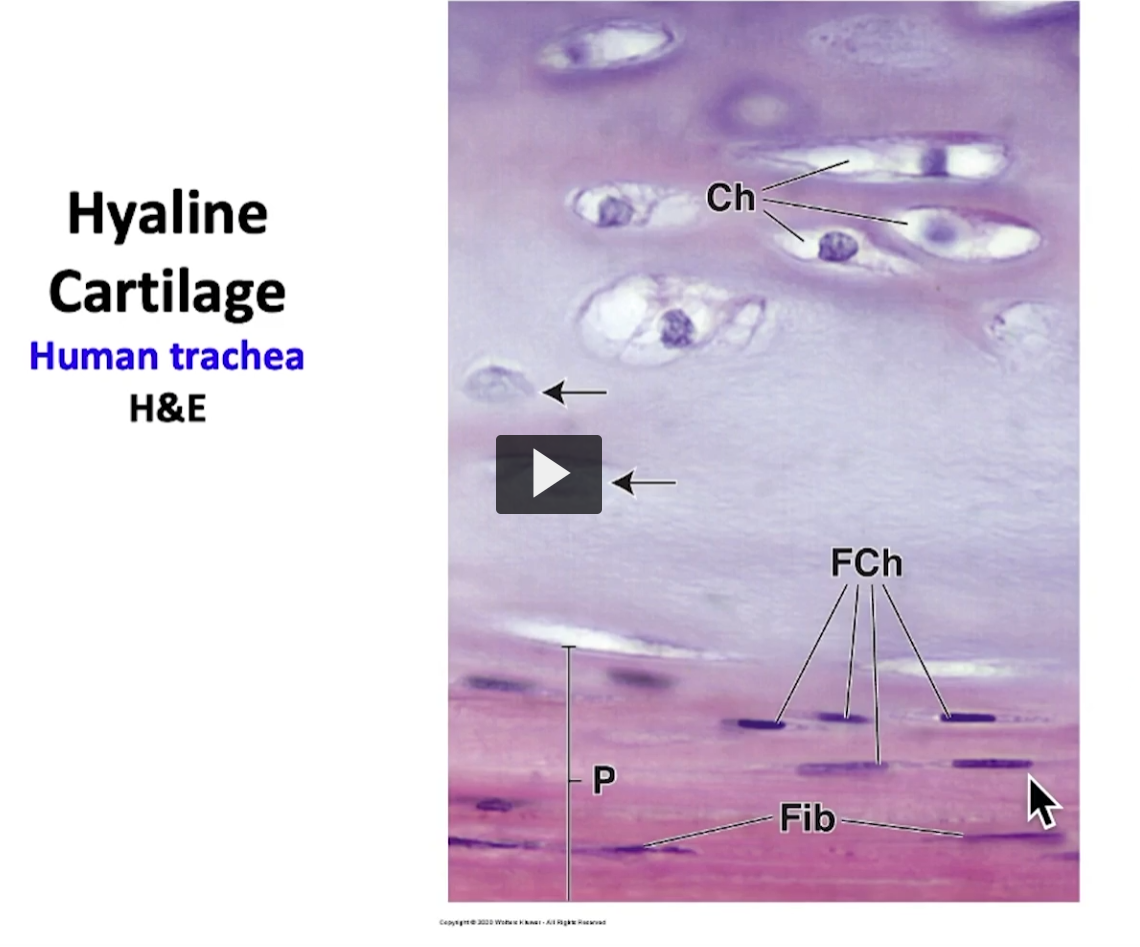<p>If I magnifiy this area of the perichondrium, this is what I can observe (next slide) </p><p>Observe here the area of perichondrium, chondrogenous layer (Ch) and a fibrous layer (Fib). These are fibroblasts (F) and these are fibroblasts that are being converted to chondroblasts (FCh), and are proximal to the chondrogenic layer where they are recently matured chondrocytes. </p><p>If I observe the mass of tissue cartilage, this is what I observe. </p>