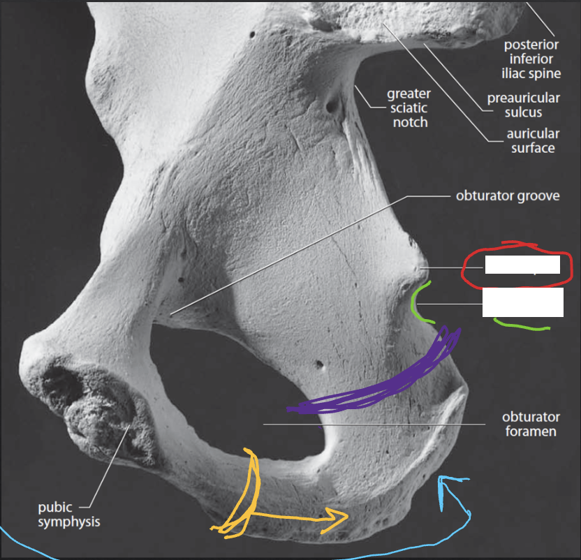 <p>Pelvis: What is the Purple?</p>