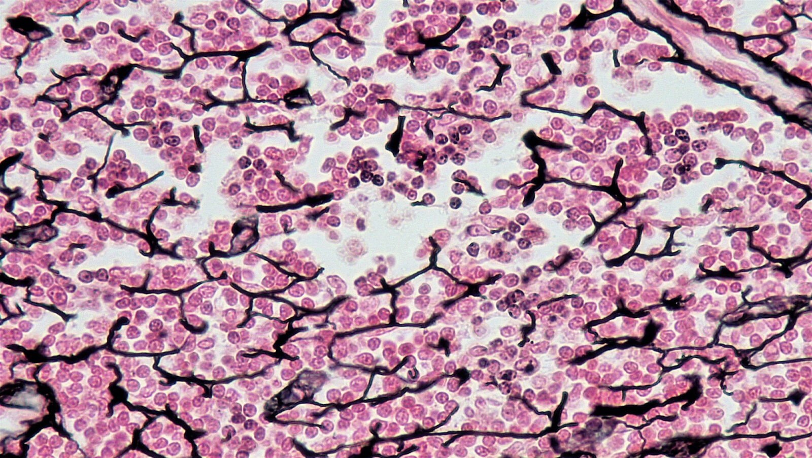 <p>Reticular Connective Tissue</p>