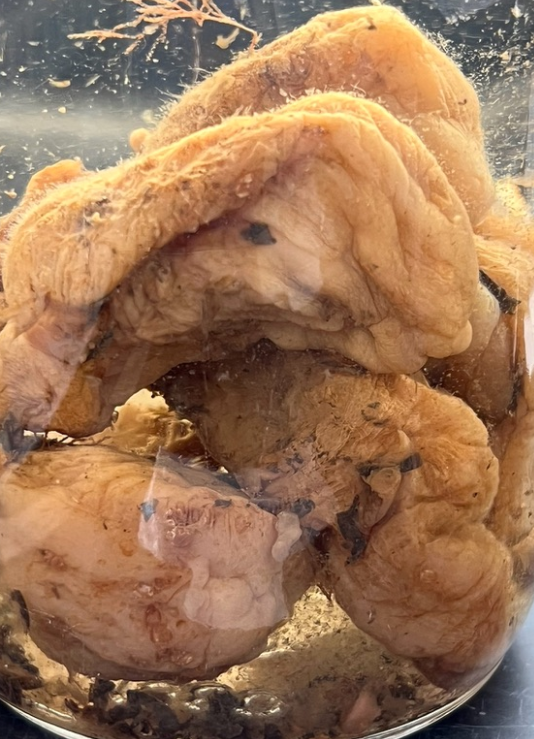 <p>What else is in Urochordata subphylum?</p>