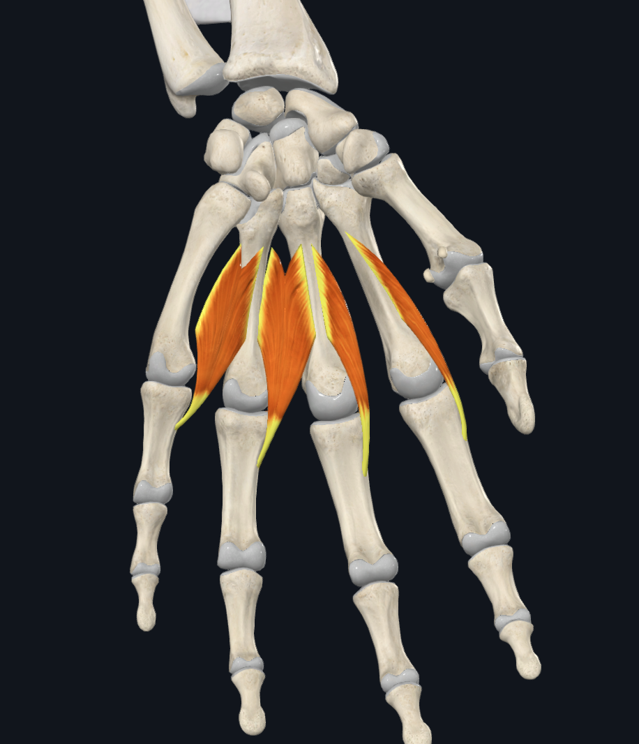 term image