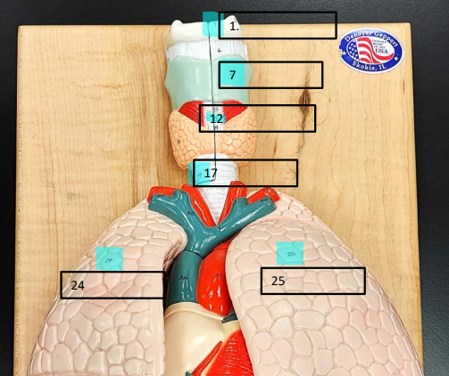<p>Label this image.</p>