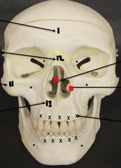 <p>Identify #12</p>