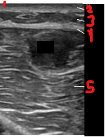 <p>Identify this image. </p>