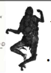 <p>soft tissues burn and contract, leading to the pugilistic pose</p><p>characterized by: charring, delamination, calcification, color change, shrinking, fracture</p>