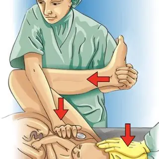 <p></p><p></p><ol><li><p><span style="color: rgb(48, 82, 162);">Apply </span><span style="color: rgb(198, 94, 232);"><strong>suprapubic pressure</strong> (<strong>avoid fundus</strong></span> to attempt to free shoulder)</p></li><li><p><span style="color: rgb(49, 154, 217);"><strong>Mvmt </strong>of <strong>babys arm</strong></span> across head to dislodge shoulder</p></li><li><p><span style="color: rgb(42, 176, 99);">Pt on <strong><u>hands and knees</u> </strong></span></p></li><li><p>Prep for <span style="color: rgb(102, 132, 39);"><strong>Episiotomy</strong></span></p></li><li><p><span style="color: rgb(62, 161, 173);"><strong>McRoberts </strong></span>maneuver: push mom legs to chest</p></li><li><p><span style="color: rgb(255, 102, 102);"><strong>Rotate</strong></span> fetus manually</p></li></ol><p></p>