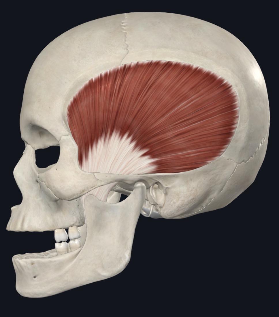 <p>Temporalis Origin</p>
