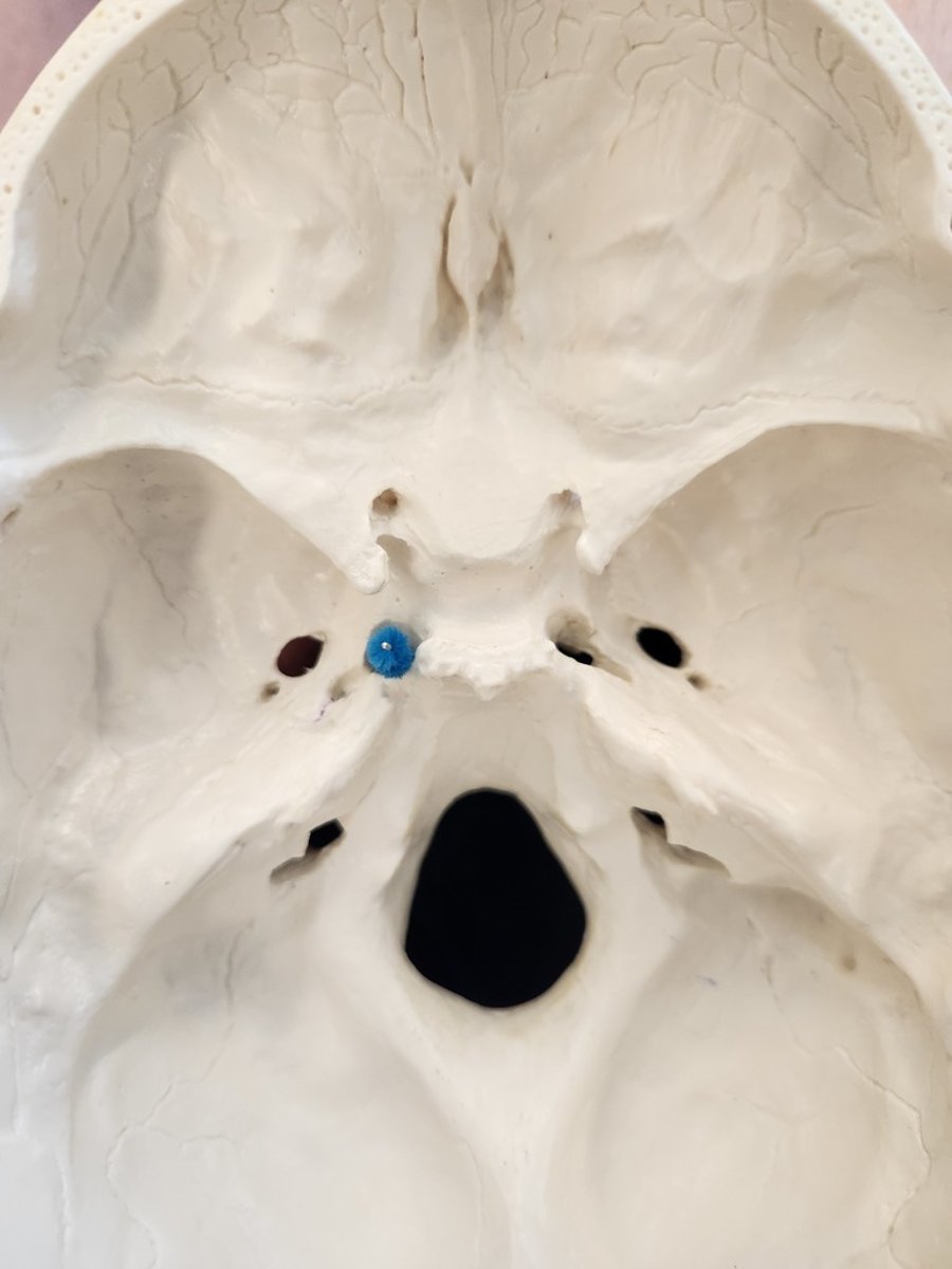 <p>What is this opening?</p><p>And what structure passes through this?</p>