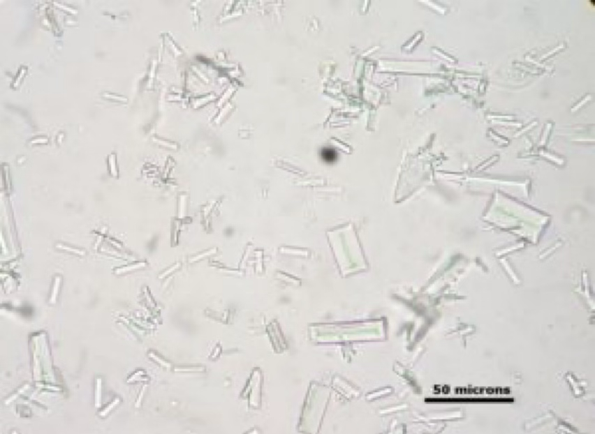 <ul><li><p>Typically seen in <strong>alkaline</strong> urine.</p></li><li><p>Resemble “coffin lids”</p></li><li><p><strong>Very common urine crystal found in dogs and some cats.</strong></p></li></ul><p></p>