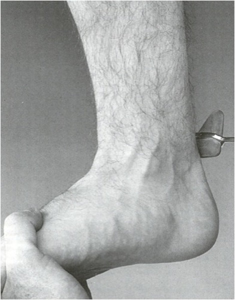 <p>position pt. w/ knee flexed, hold foot in dorsiflexion and strike achilles tendon directly</p><p>normally foot plantar flexes against your hand</p>