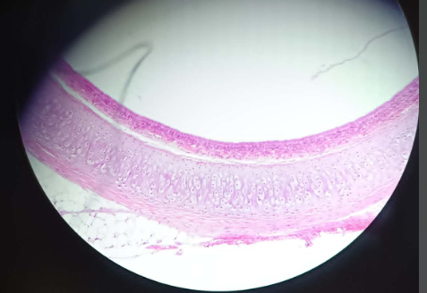 <p>Trachea pseudostratified epithelium - HE (22)</p><ul><li><p>part of the respiratory tract</p></li><li><p>pseudostratified and columnar ciliated epithelium</p></li><li><p>3 types of cells</p><ul><li><p>columnar ciliated cells</p></li><li><p>stem cells (basal cells)</p></li><li><p>goblet cells</p></li></ul></li></ul><ol><li><p>Tunica Mucosa</p><ol><li><p>Lamina Propria - LCT to glands</p></li></ol></li><li><p>Tunica fibromusculocartilaginea - contains cartilage (hyaline cartilage), 2 ends of cartilage are linked together by muscle layer</p></li><li><p>Tunica Adventitia - loose connective tissue</p></li></ol><p></p>