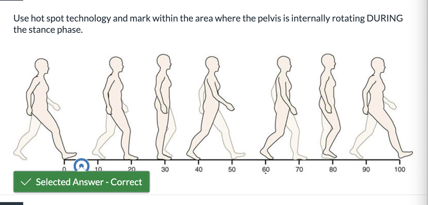 <p><span>Use hot spot technology and mark within the area where the pelvis is internally rotating DURING the stance phase.</span></p>
