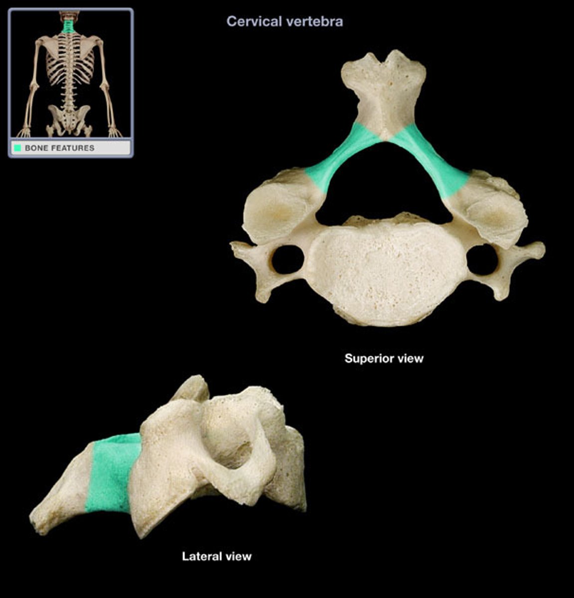 <p>(name of the vertebra part)</p>