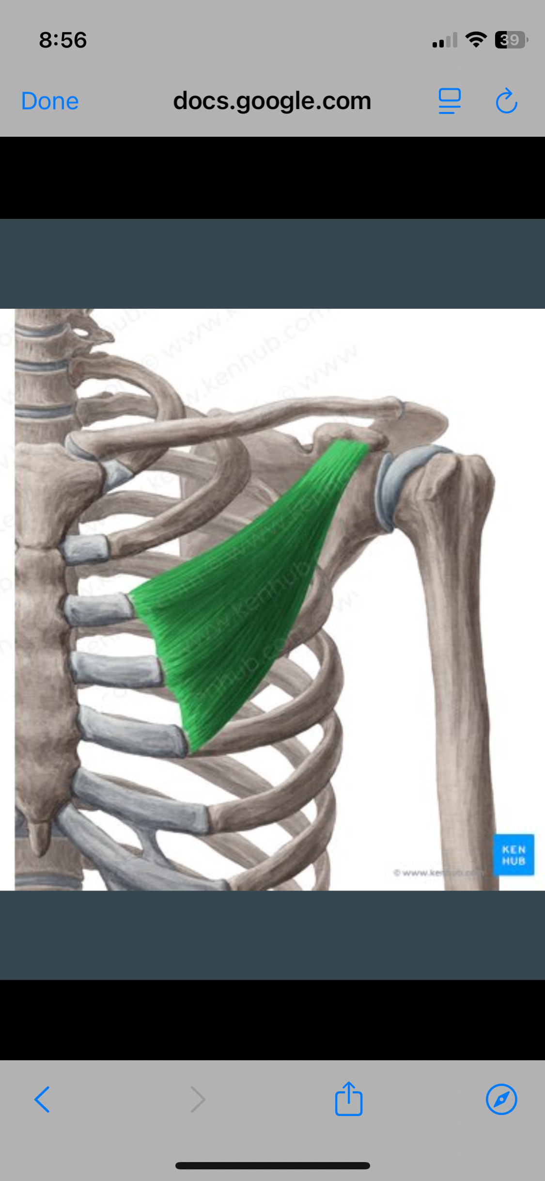 <p>Pectoralis Minor</p>