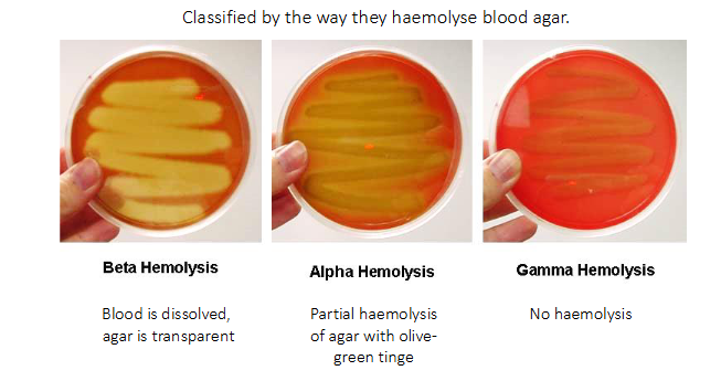 <p>- Classified by the way they haemolyse blood agar</p><p>.</p><p>BETA HAEMOLYSIS:</p><p>- blood is dissolved, agar is transparent</p><p>.</p><p>ALPHA HAEMOLYSIS:</p><p>- partial haemolysis of agar with olive-green tinge</p><p>.</p><p>GAMMA HAEMOLYSIS:</p><p>- No haemolysis</p>