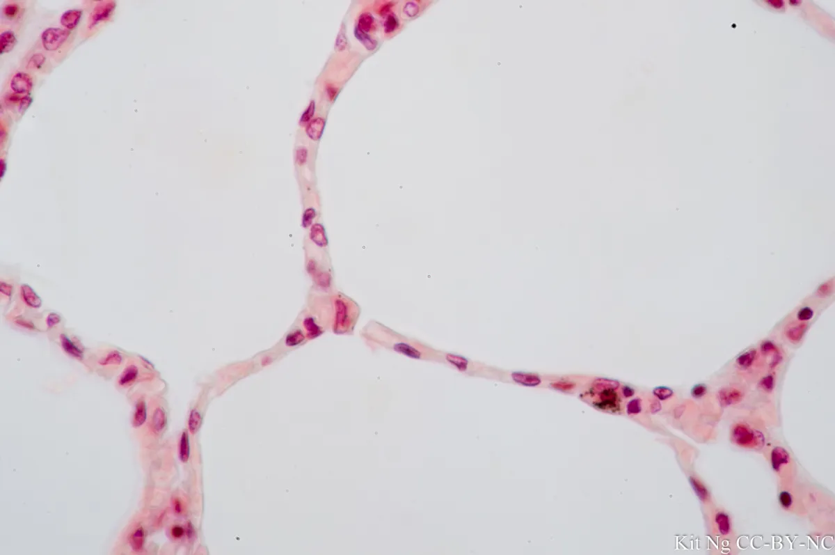 <p>Simple Squamous</p>