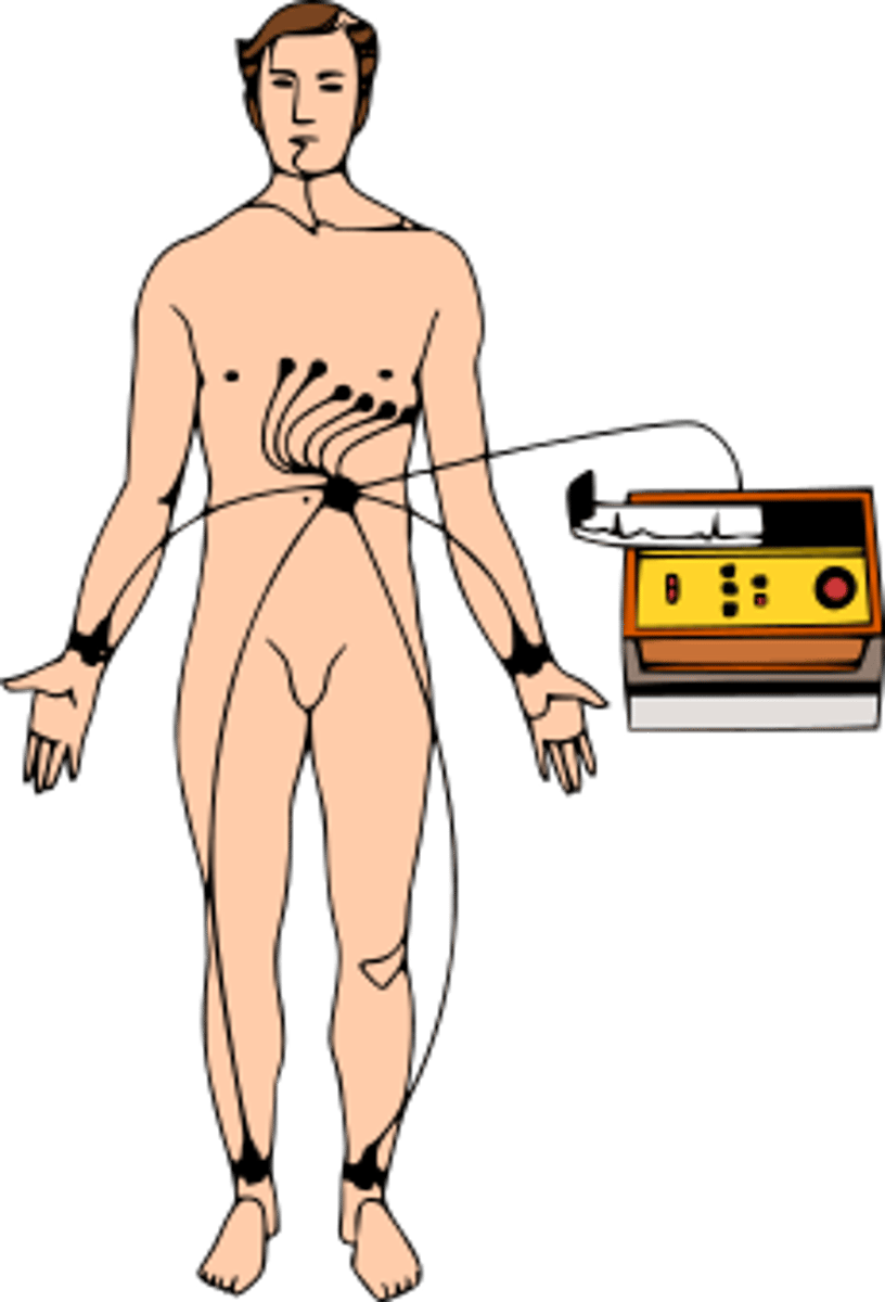 <p>wires connected to monitor heart activity; alarm may sound if dislodged</p>