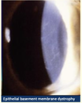 <p>Describe and give diagnosis </p>