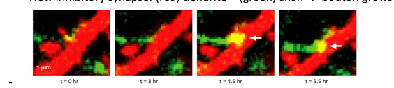 <p>Who/what decides when and where this inhibitory bouton occurs?</p>