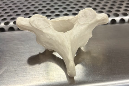 <p>What kind of vertebrae is this?</p>