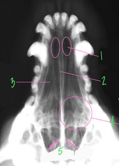 <p>What is 5 in this normal radiograph?</p>
