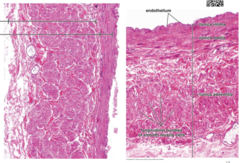 <p>Which vessels may have internal elastic lamina in the tunica intima, has a few layers of smooth muscle in the tunica media, and has a thick tunica adventitia with many densely arranged longitudinal smooth muscle bundles and vasa vasorum?</p>