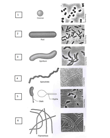 <p>1) sferische bacterie: coccus</p><p>2) staafvormige bacterie: bacillus</p><p>3) spiraalvormige bacterie: spirillum</p><p>4) spiraalvormige bacterie die zeer sterk opgewonden is: spirochete</p><p>5) bacterie met aanhangsels of steel</p><p>6) filamenteuze bacteriën</p>