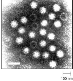 <p>determined more by patient symptoms </p><p>diagnostic tests include</p><ul><li><p>culturing the virus</p></li><li><p>detecting a virus by </p><ul><li><p>molecular techniques (PCR)</p></li><li><p>EM</p></li><li><p>injection into animal → antibodies to virus </p></li></ul></li></ul><p></p>