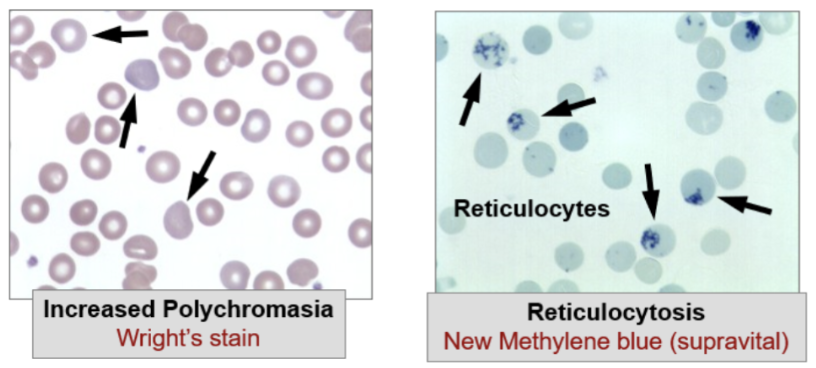 <ul><li><p><span style="background-color: transparent;">Retic count (absolute)</span></p></li><li><p><span style="background-color: transparent;">Measures rate of RBC production by the bone marrow</span></p></li><li><p><span style="background-color: transparent;">Helps differentiate normocytic anemias</span></p></li></ul><p></p>