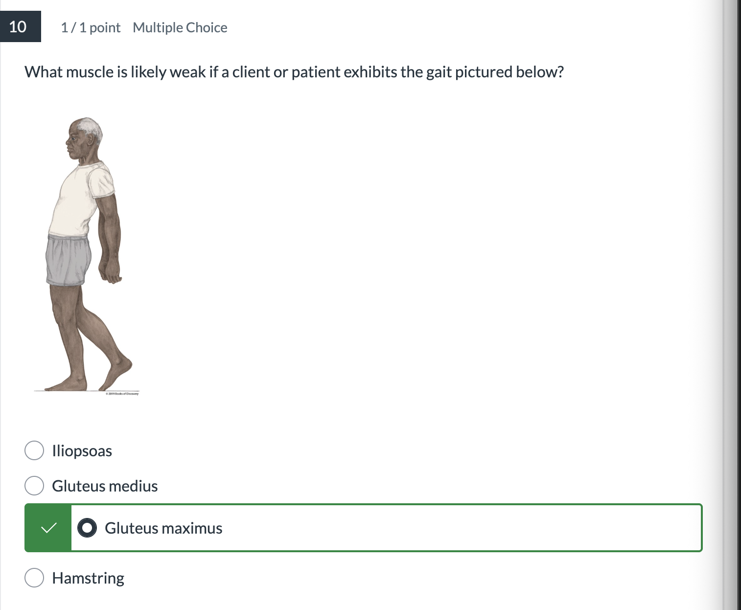 <p>What muscle is likely weak if a client or patient exhibits the gait pictured below?</p>