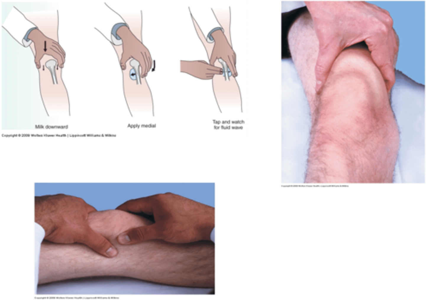 <p>tests for increased fluid in joint</p>