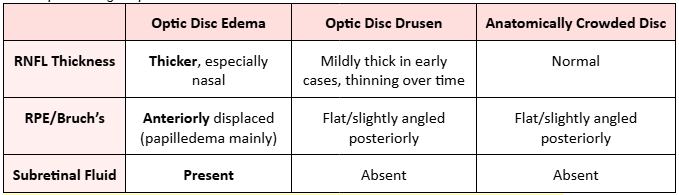 <ul><li><p><span style="background-color: transparent;">Evaluates the peripapillary RNFL and macular Ganglion Cell Layer (GCL)</span></p></li><li><p><span style="background-color: transparent;">May be helpful in diagnosing early disc edema</span></p></li><li><p><span style="background-color: transparent;">Useful to monitor progression&nbsp;</span></p></li></ul><p><span style="background-color: transparent;"><strong>Subretinal hyporeflective space (SHYPS)</strong>&nbsp;</span></p><ul><li><p><span style="background-color: transparent;">Presence occurs in conditions where the <u>optic disc is elevated</u></span></p></li><li><p><span style="background-color: transparent;">Hyporeflective space on OCT cross-section <u>below the photoreceptors</u> (neurosensory retina)</span></p></li><li><p><span style="background-color: transparent;">Smooth internal contour; <strong>lazy V pattern</strong>&nbsp;</span></p></li><li><p><span><strong>Optic disc edema</strong></span><span style="background-color: transparent;">: <u>smooth</u> internal contour, “lazy V” pattern</span></p></li><li><p><span><strong>Optic disc drusen</strong></span><span style="background-color: transparent;">: <u>lumpy-bumpy</u> internal contour, abrupt decline in SHYPS</span></p></li></ul><p><span><strong><em>OCT alone CANNOT definitely differentiate optic disc edema from pseudo disc edema</em></strong>&nbsp;</span></p><p><br></p>