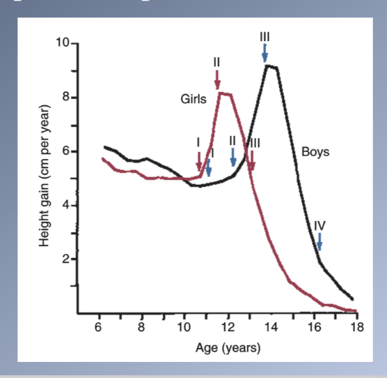 <p><span>Beginning of the physical growth spurt (PGS)</span><br><span>1) Appearance of breast buds</span><br><span>2) Early stages of the development of pubic hair</span></p><p><span>II. Peak velocity (1 year after stage 1)</span><br><span>1) Noticeable breast development</span><br><span>2) Pubic hair is darker and more widespread</span><br><span>3) Axillary hair</span></p><p><span>III. Onset of menstruation (1-1.5 year after stage 2)</span><br><span>1) Growth spurt is almost complete</span><br><span>2) Broadening of the hips</span><br><span>3) Adult fat distribution</span><br><span>4) Development of breasts is complete</span></p>