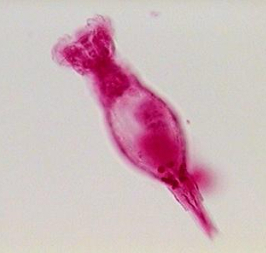 <p>phylum: rotifera</p>